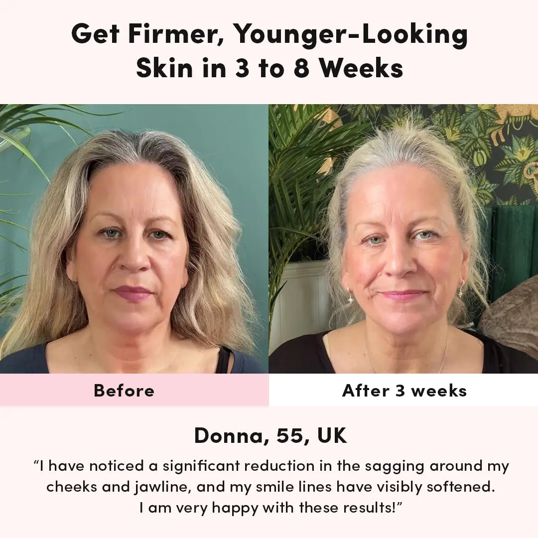 RegenMask™ LED & Microcurrent Mask for Lifting Jowls, Cheeks, and Lower Face
