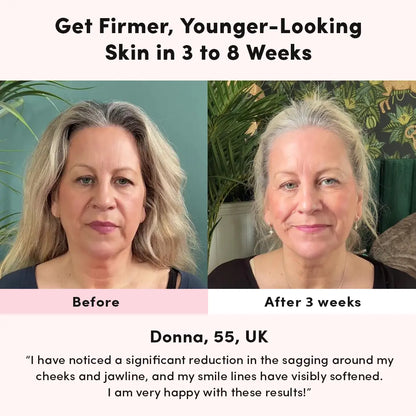 RegenMask™ LED & Microcurrent Mask for Lifting Jowls, Cheeks, and Lower Face